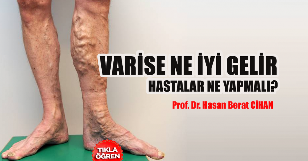 Varise ne iyi gelir